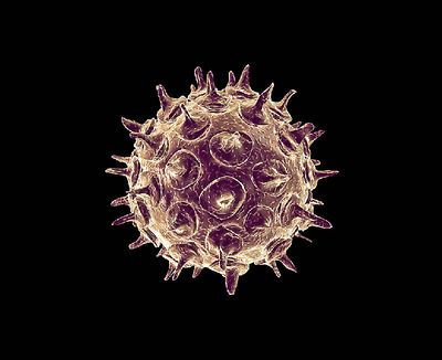 400px-Varicella-zoster_virus_enhanced_by_an_electron_microscope